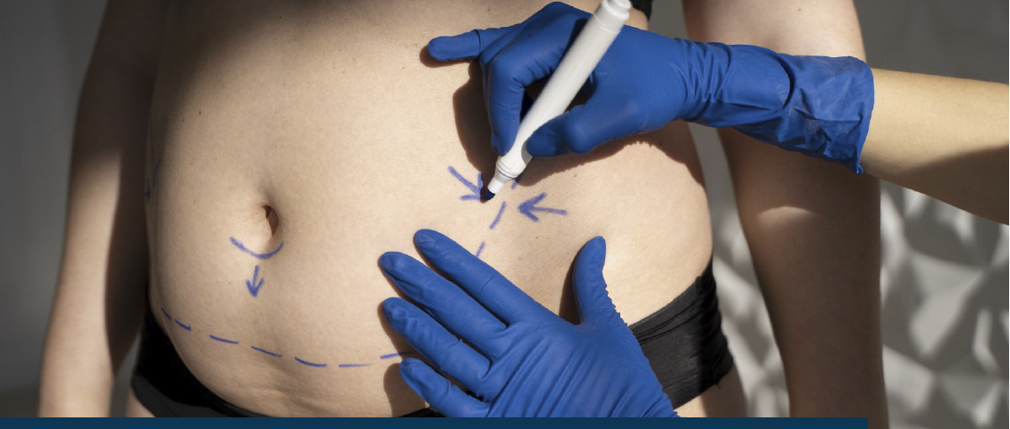 Priorice calidad, seguridad y experiencia