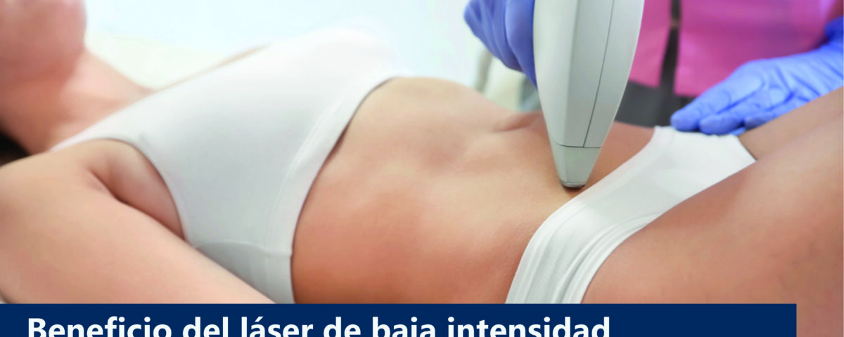 El láser de baja intensidad para reducir grasa