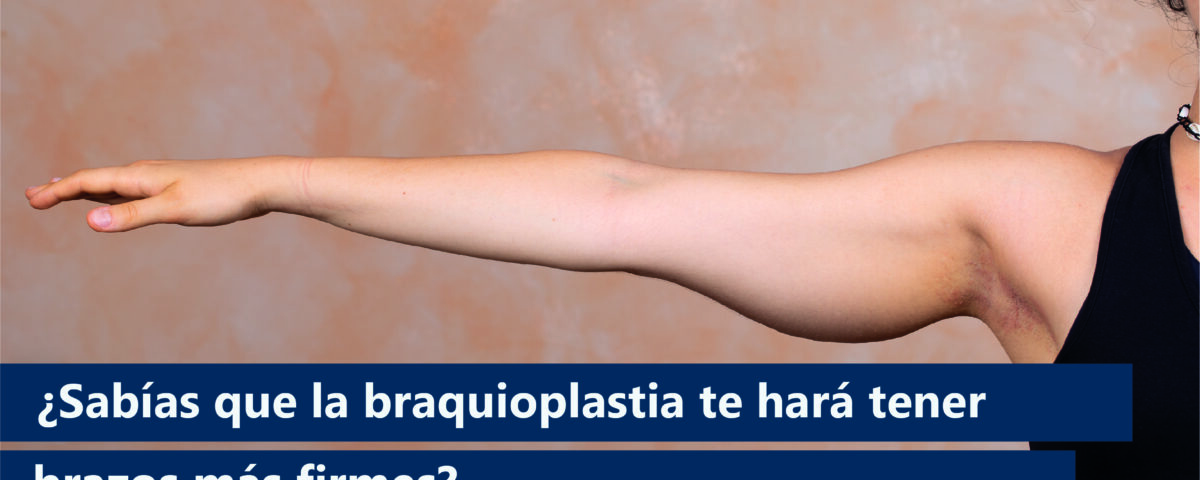 La braquioplastia, también conocida como lifting de brazos, es una cirugía plástica que elimina el exceso de piel y grasa en la parte superior de los brazos, proporcionando una apariencia más firme y estilizada.