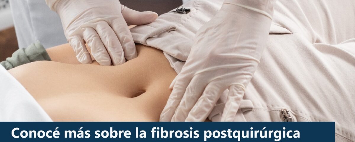4 datos fundamentales de la fibrosis postquirúrgica que deberías saber